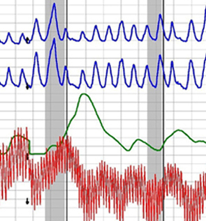 Polygraph test in Berkeley